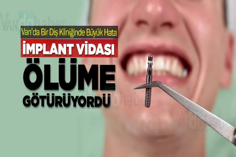 Van'da İmplant Vidası Ölüme Götürüyordü