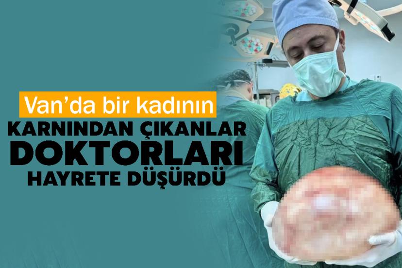 Van’da bir kadının karnından çıkanlar doktorları hayrete düşürdü