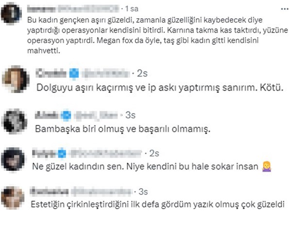 Estetiğin dozunu kaçıran Adriana Lima'nın gözleri küçücük kaldı