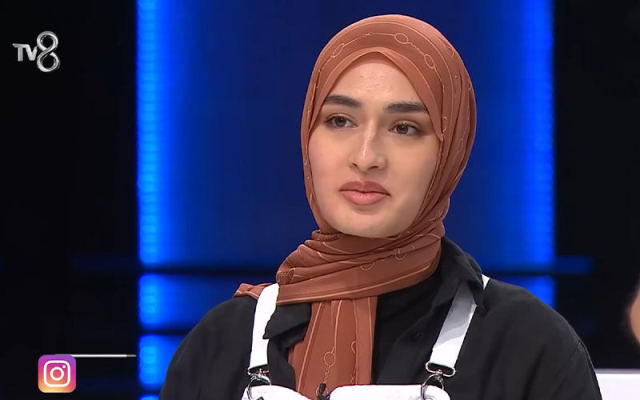 Yüzü yanan MasterChef Beyza sargısını çıkardı, akıllara kurgu şüphesi geldi