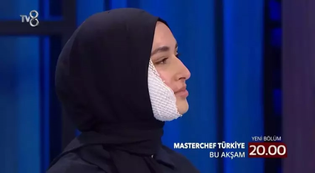 Masterchef'te yüzü yanan Beyza'nın son hali