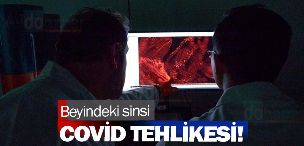 Beyindeki sinsi Covid tehlikesi!