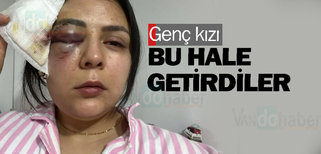 Genç kızı bu hale getirdiler